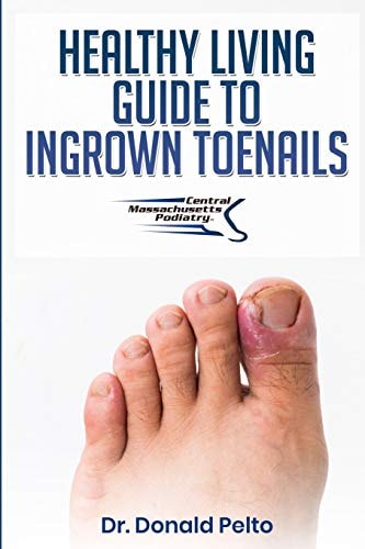 The Healthy Living Guide to Ingrown Toenails