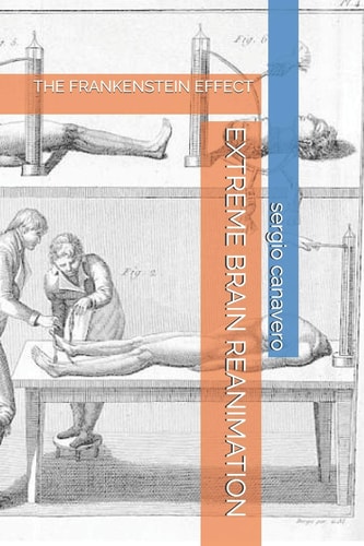 Extreme Brain Reanimation The Frankenstein Effect