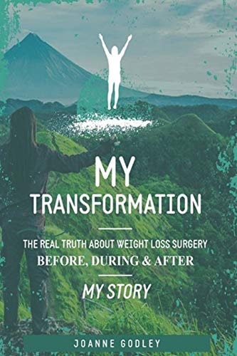 My Transformation... The Real Truth about Weight Loss Surgery My Story