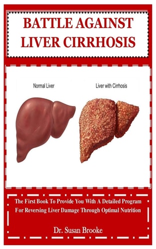 Battle Against Liver Cirrhosis The First Book To Provide You With A Detailed Program For Reversing Liver Damage Through Optimal Nutrition