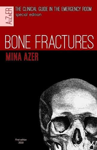 Bone Fractures Special Edition of the Clinical Guide in the Emergency Room.