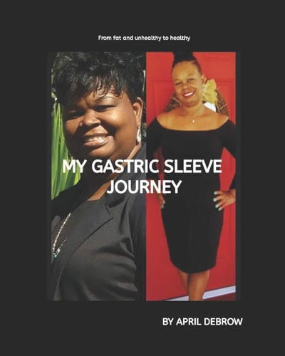 My Gastric Sleeve Journey The Ends and Outs About Gastric Sleeve