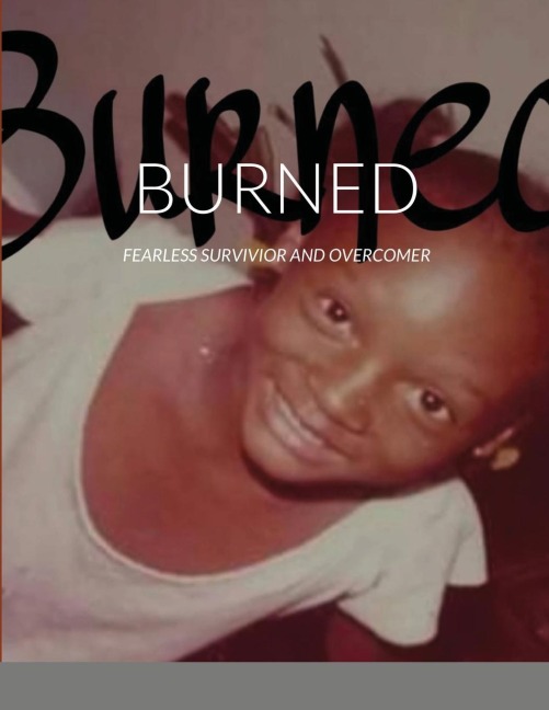 BURNED: FEARLESS SURVIVIOR AND OVERCOMER