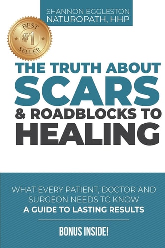 The Truth About Scars and Roadblocks to Healing What Every Patient, Doctor, and Surgeon Needs to Know