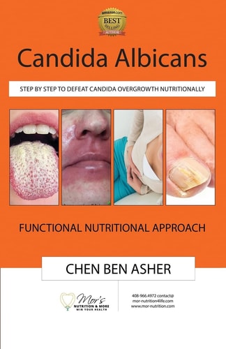 Candida Albicans Step by Step to Defeat Candida Overgrowth Nutritionally