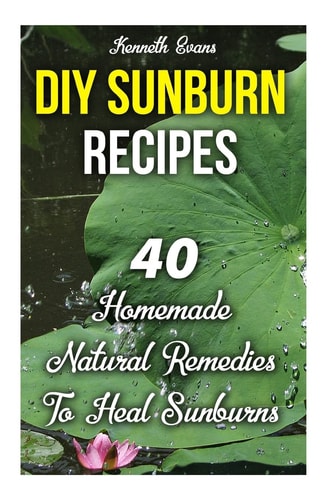 DIY Sunburn Recipes 40 Homemade Natural Remedies To Heal Sunburns