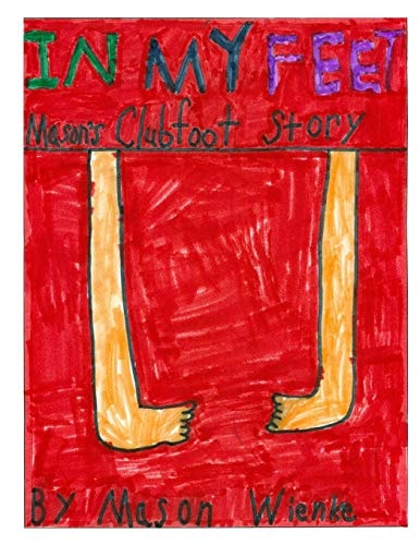 In My Feet Mason's Clubfoot Story