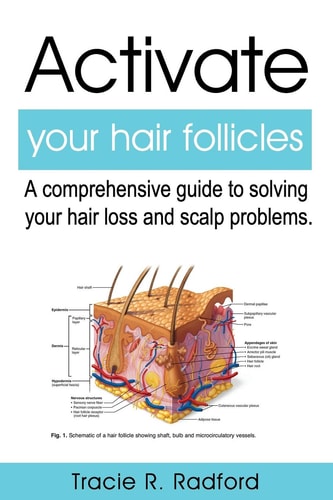 Activate Your Hair Follicles A Comprehensive Guide to Solving Your Hair Loss and Scalp Problems