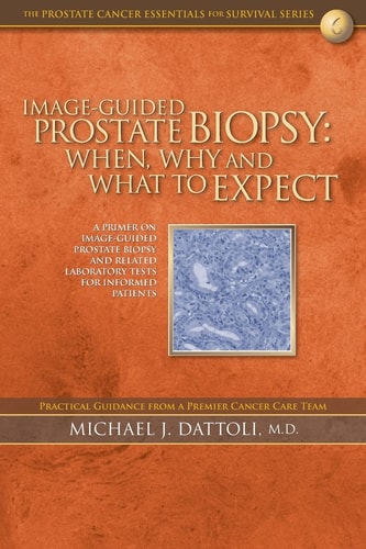Image-Guided Prostate Biopsy When, Why and What to Expect
