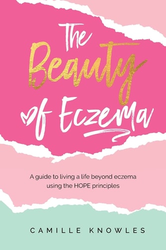The Beauty of Eczema A Guide To Living a Life Beyond Eczema Using The Hope Principles
