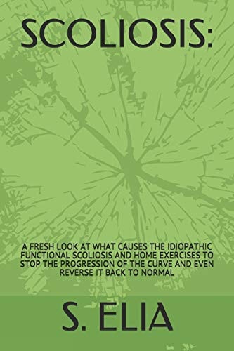 Scoliosis : A Fresh Look at What Causes the Idiopathic Functional Scoliosis and Home Exercises to Stop the Progression of the Curve and Even Reverse It Back to Normal