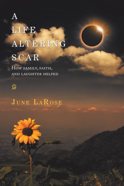 A Life Altering Scar: How Family, Faith, and Laughter Helped