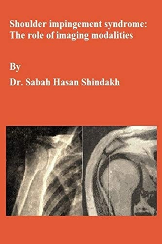 Shoulder Impingement Syndrome The Role of Imaging Modalities: Master Thesis
