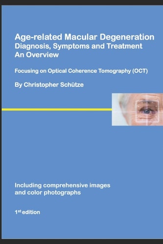 Age-Related Macular Degeneration, Diagnosis, Symptoms and Treatment, an Overview Focusing on Optical Coherence Tomography