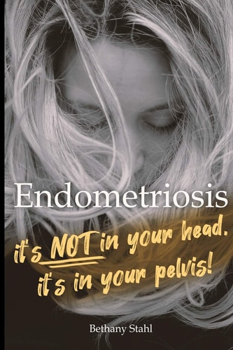 Endometriosis It's Not in Your Head, It's in Your Pelvis