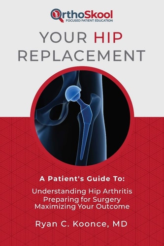 Your Hip Replacement A Patient's Guide To: Understanding Hip Arthritis, Preparing for Surgery, Maximizing Your Outcome