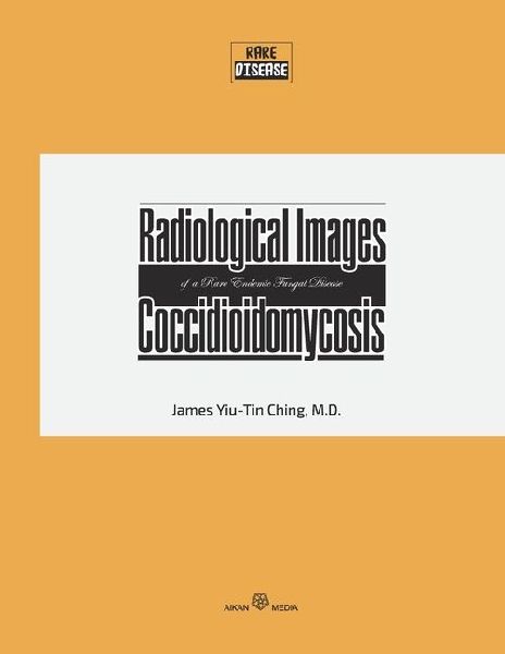 Radiological Images of a Rare Endemic Fungal Disease Coccidioidomycosis