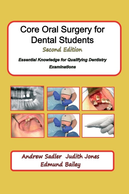Core Oral Surgery for Dental Students Second Edition: Essential Knowledge for Qualifying Dentistry Examinations