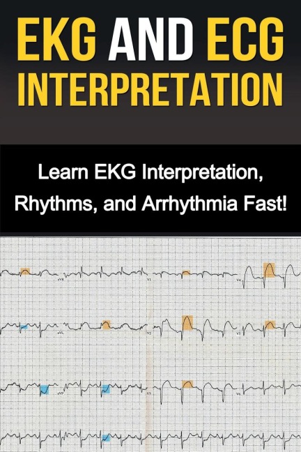 EKG and ECG Interpretation: Learn EKG Interpretation, Rhythms, and Arrhythmia Fast!