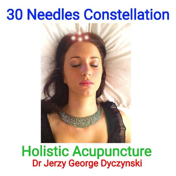 30 Needles Constellation Acupuncture: Holistic Acupuncture