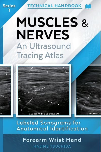 Muscles & Nerves - Technical Ultrasound Handbook: An Ultrasound Tracing Atlas (Series 1)