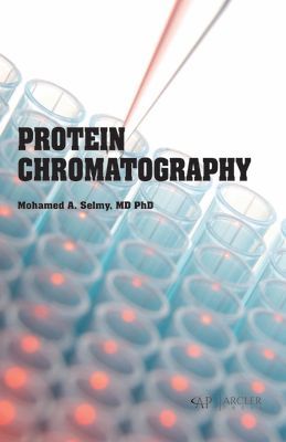 Protein Chromatography