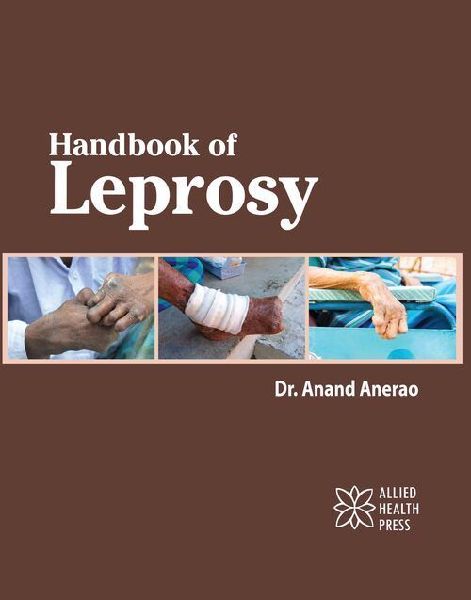 Handbook of Leprosy