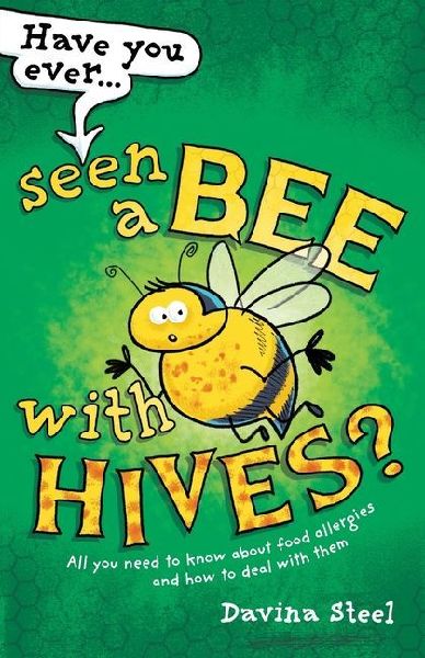 Have You Ever Seen a Bee with Hives?: All you need to know about food allergies and how to deal with them