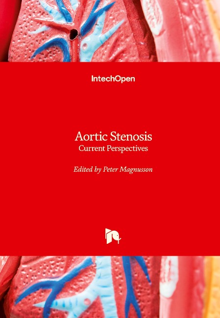 Aortic Stenosis: Current Perspectives
