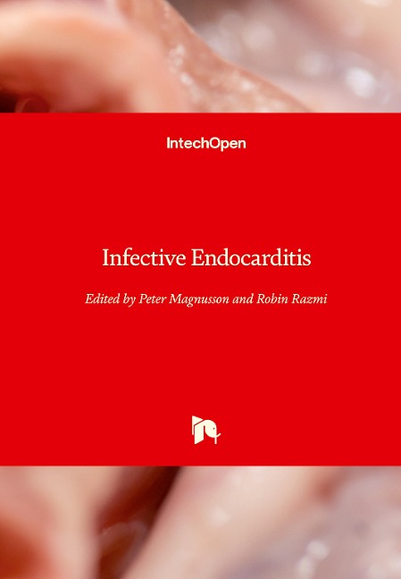Infective Endocarditis