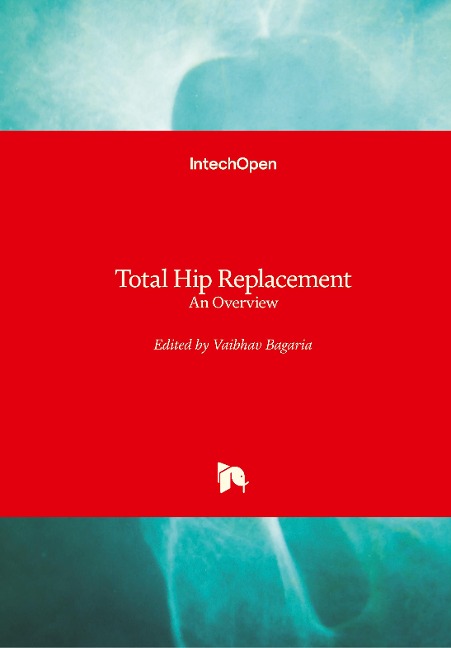 Total Hip Replacement: An Overview