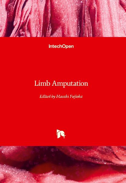 Limb Amputation