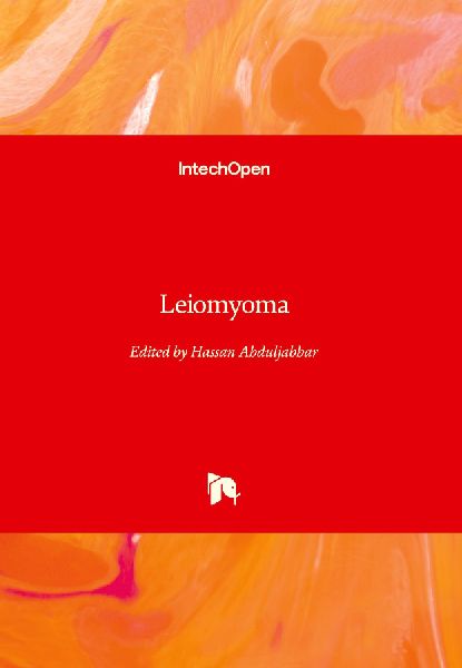 Leiomyoma