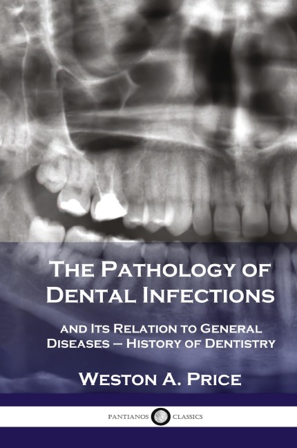 Pathology of Dental Infections: and Its Relation to General Diseases - History of Dentistry