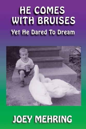 He Comes with Bruises Yet He Dared To Dream
