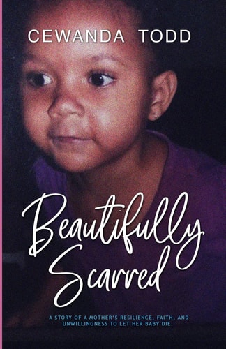 Beautifully Scarred A Story of a Mother's Resilience, Faith, and Unwillingness to Let Her Baby Die.