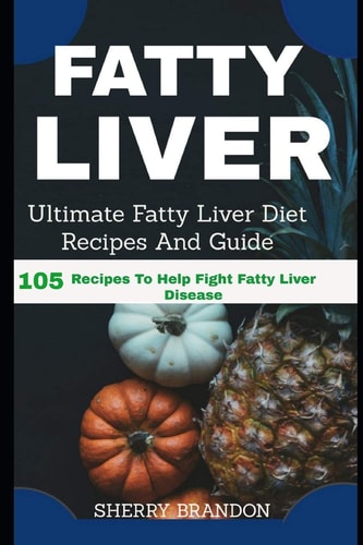 Fatty Liver Diet Ultimate Fatty Liver Diet Recipes And Guide 105 Recipes To Help Fight Fatty Liver Disease (Fatty Liver Cure, Fatty Liver Reverse, Fatty Liver Healing, Fatty Liver Diet)