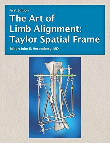The Art of Limb Alignment Taylor Spatial Frame