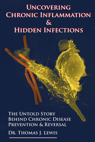 Uncovering Chronic Inflammation and Hidden Infections The Untold Story Behind Chronic Disease Prevention and Reversal