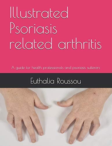 Illustrated Psoriasis Related Arthritis A Guide for Health Professionals and Psoriasis Sufferers