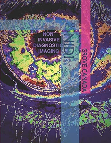Nidi
