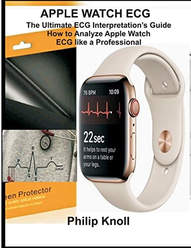 Apple Watch ECG The Ultimate ECG Interpretation Guide; How to Analyze Apple Watch ECG Like a Professional