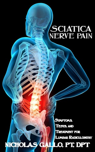 Sciatica Nerve Pain Symptoms, Tests, and Treatments for Lumbar Radiculopathy