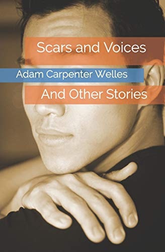 Scars and Voices And Other Stories