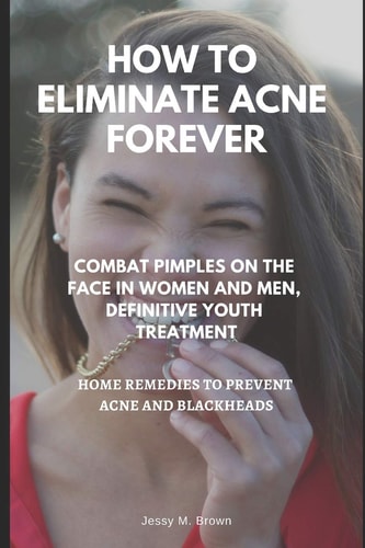 How to Eliminate Acne Forever Combat Pimples on the Face in Women and Men, Definitive Juvenile Treatment, Home Remedies to Prevent Acne and Blackheads
