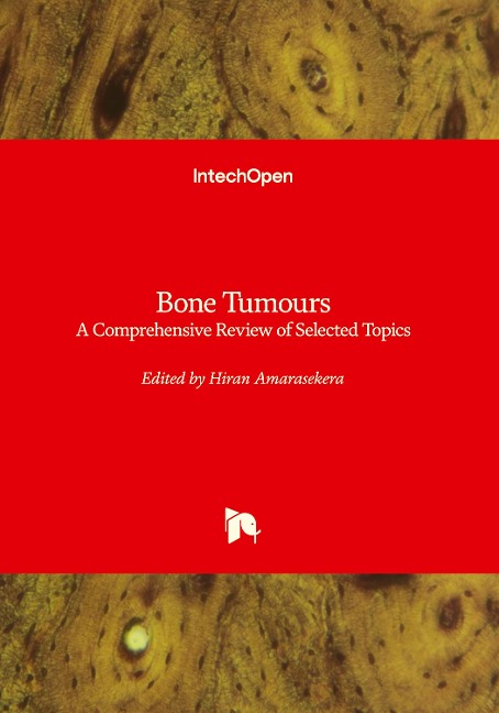 Bone Tumours: A Comprehensive Review of Selected Topics