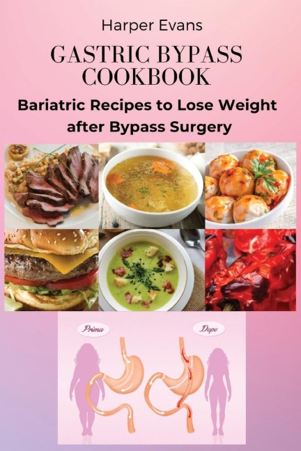 GASTRIC BYPASS COOKBOOK: Bariatric Recipes to Lose Weight  after Bypass Surgery