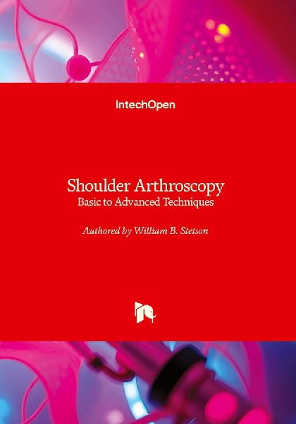 Shoulder Arthroscopy - Basic to Advanced Techniques: Basic to Advanced Techniques