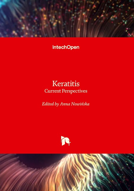 Keratitis: Current Perspectives