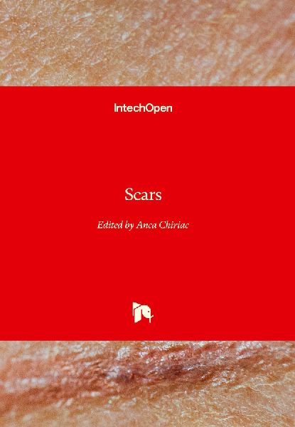 Scars